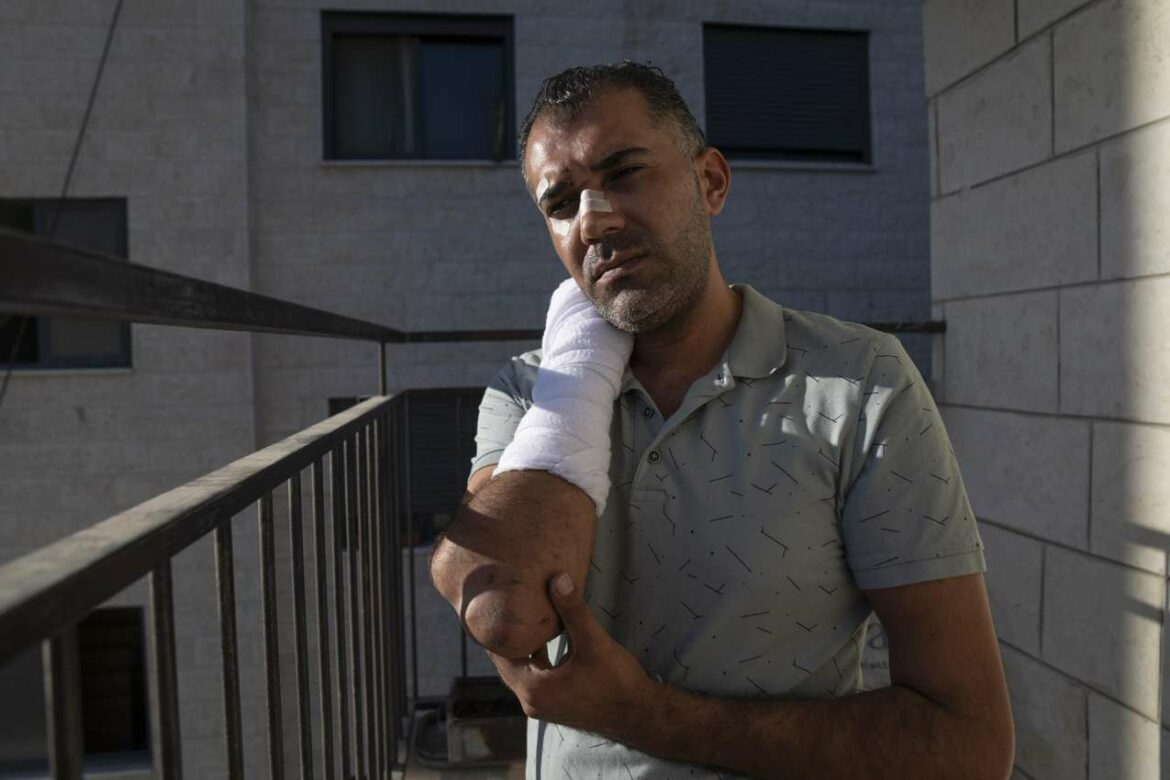 Palestinac je otišao pretučen, okrvavljen od strane izraelske policije