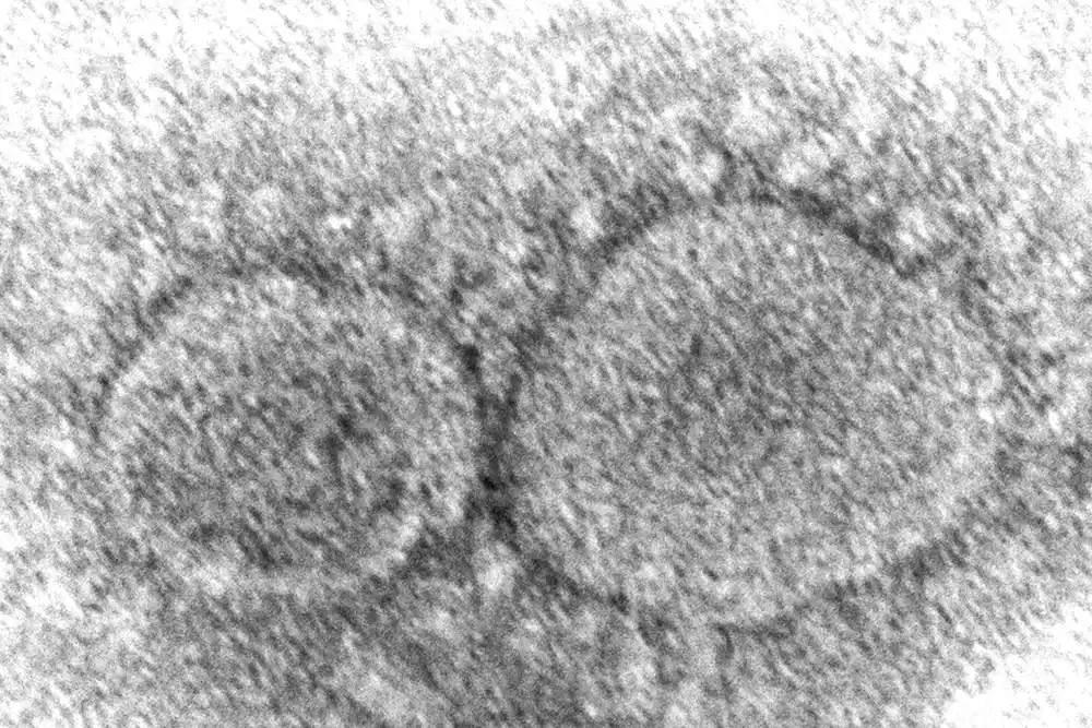 Poreklo koronavirusa i dalje je misterija tri godine nakon pandemije