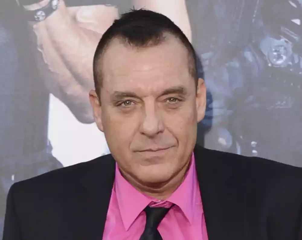 Tom Sizemore u kritičnom stanju nakon aneurizme mozga