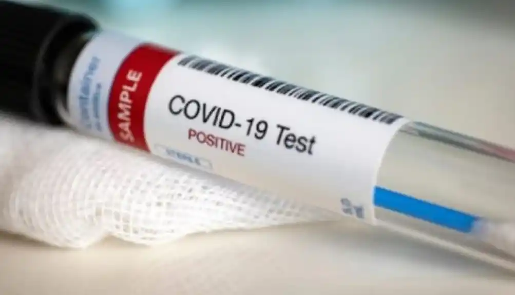 Preminula jedna osoba, 61 novi slučaj koronavirusa