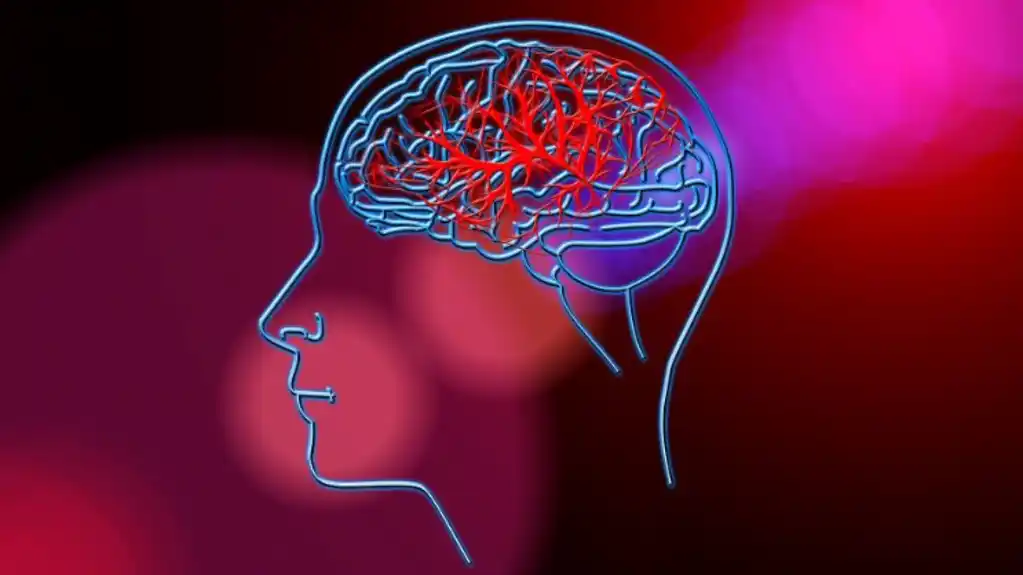 Poražavajuće: Sve je više moždanih udara među mlađim odraslim osobama