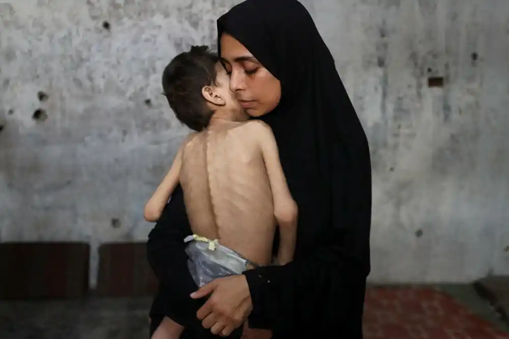 UNICEF upozorava da sve više djece u Gazi umire od gladi, još devet osoba umrlo od neuhranjenosti