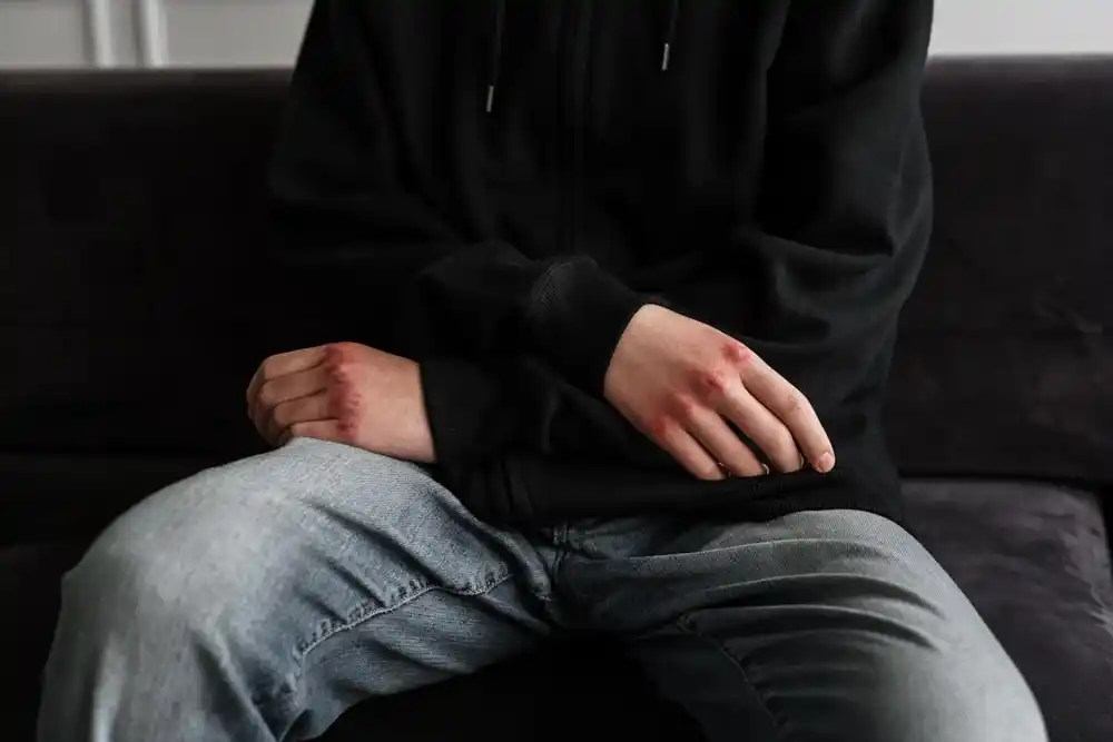 Baranin slomio jagodičnu kost i vilicu osamnaestogodišnjem sugrađaninu