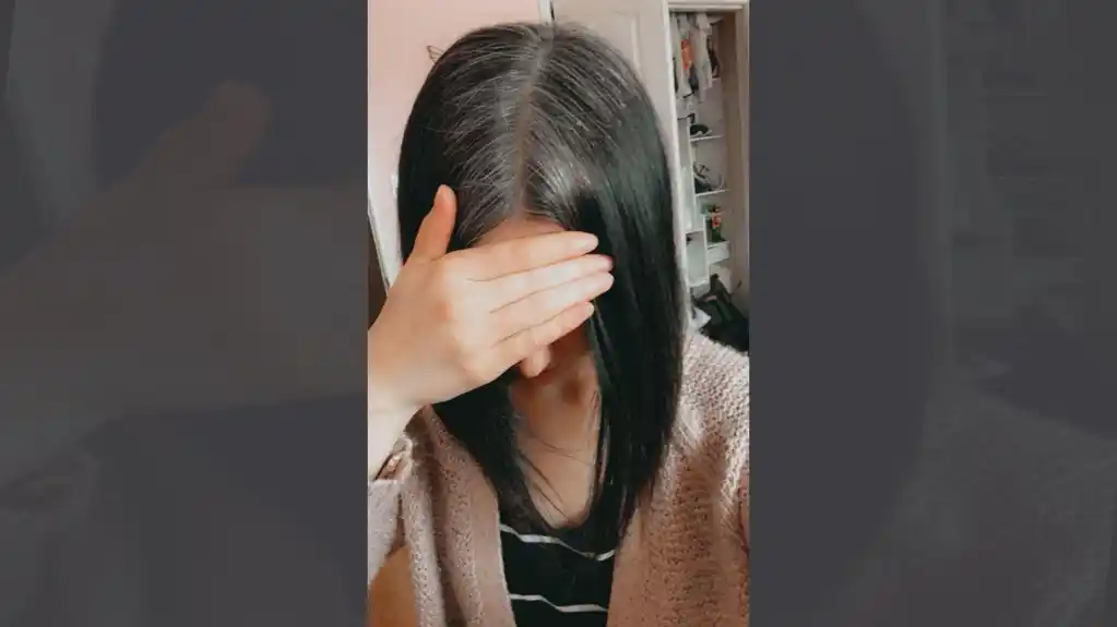 Kako nekima kosa posijedi već u tinejdžerskom dobu