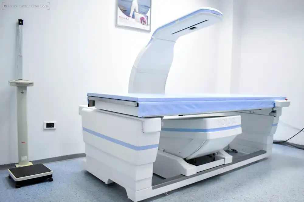 U Kliničkom centru Crne Gore instaliran najsavremeniji aparat za osteodenzitometriju