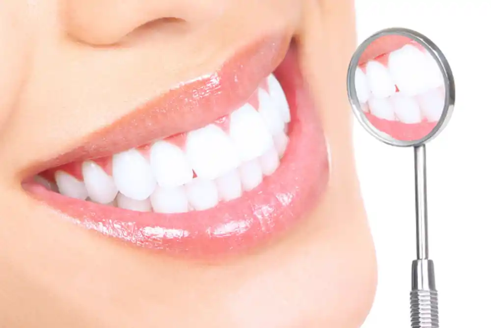 Šećer nije jedini krivac: Stomatolog otkriva kako da sačuvate zubnu gleđ