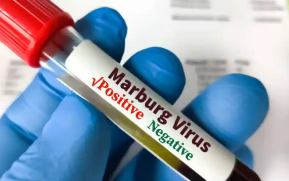 U Etiopiji izbila epidemija marburške virusne infekcije