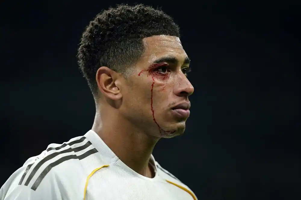 U Realu ogorčeni: Belingem dobio udarac u glavu, a Iglesijas završio bez kartona