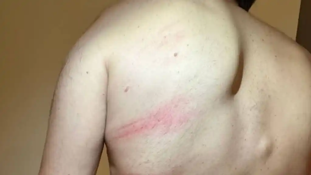 Podgoričanin tvrdi da su ga specijalci brutalno pretukli; UP: Napao ih je