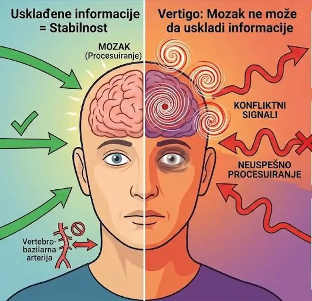 Problem koji nije lako riješiti: Šta je vertigo?