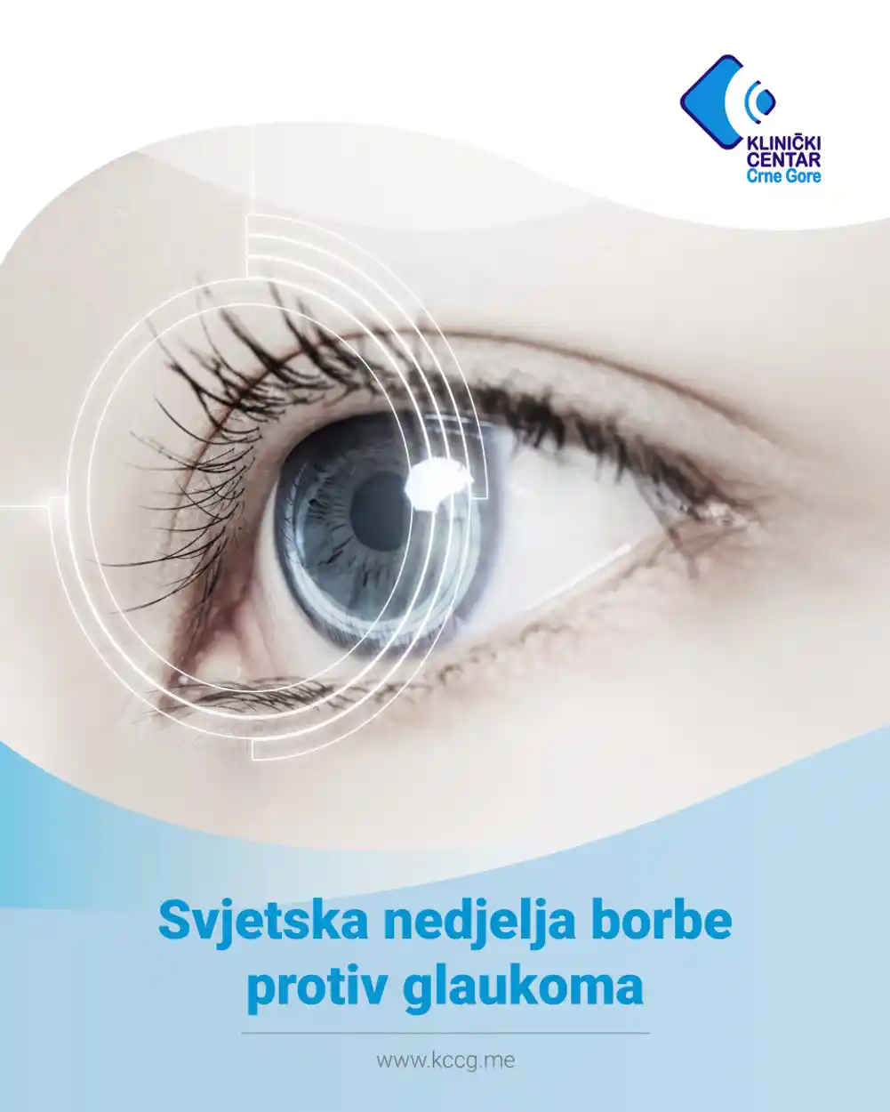 Svjetska nedjelja borbe protiv glaukoma