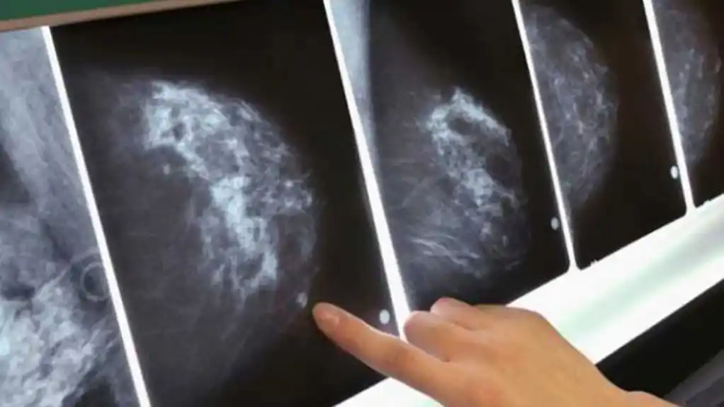 Farba za kosu povećava rizik od raka dojke