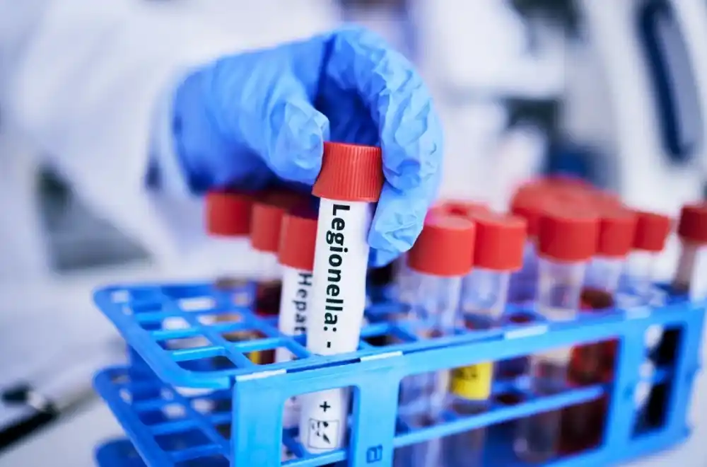 Epidemija opasne bolesti hara Njujorkom: Preminula još jedna osoba