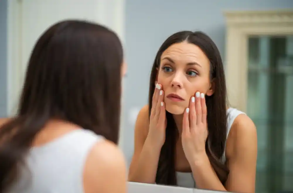 Gnojne akne nisu samo estetski problem: Hormonske promjene mogu da budu okidači