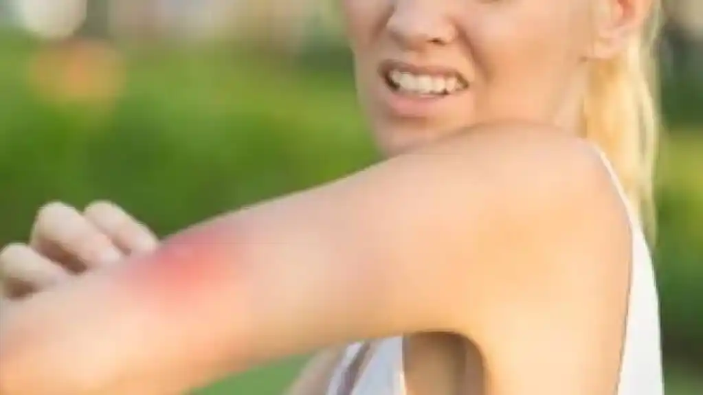 Hitno liječenje teških alergijskih reakcija: EpiPen se kupuje u inostranstvu, Fond može nadoknaditi troškove