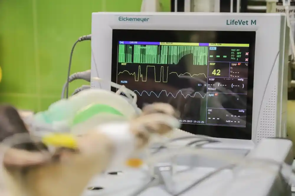 Vještačka inteligencija za dvije sekunde iz EKG snimka otkriva znakove srčane bolesti