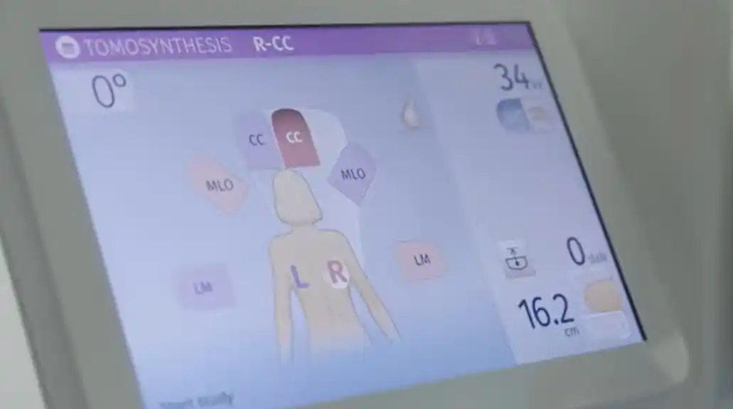 Produžava se akciju besplatnih mamografskih pregleda i tokom novembra